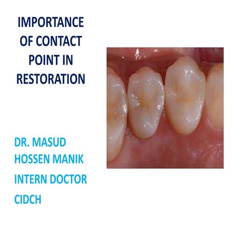 IMPORTANCE OF CONTACT POINT IN RESTORATION_104437.pptx