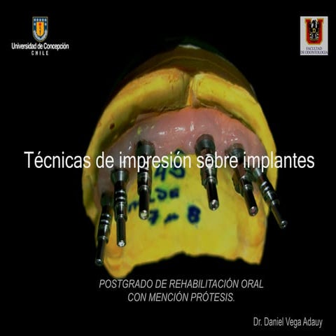 Impresiones sobre implantes