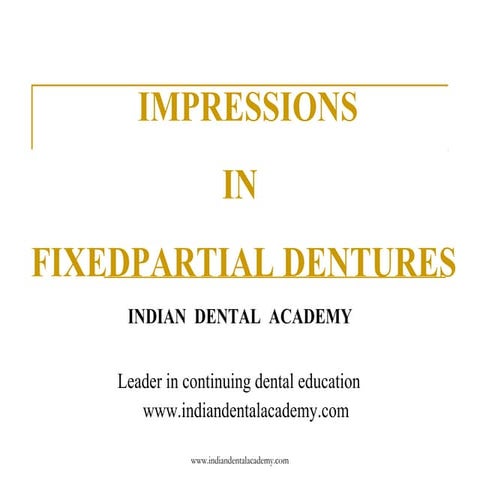 Impressions for fpd / implant dentistry course