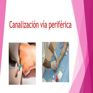 Canalización de vias