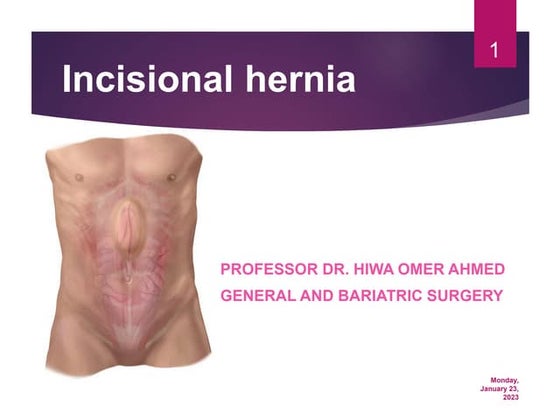 Triad of death, damage controle surgery.ppt