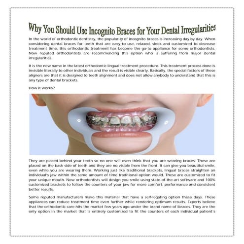 Your Guide to Invisalign | PDF