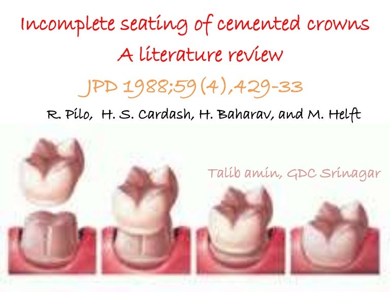 seating of cement crowns