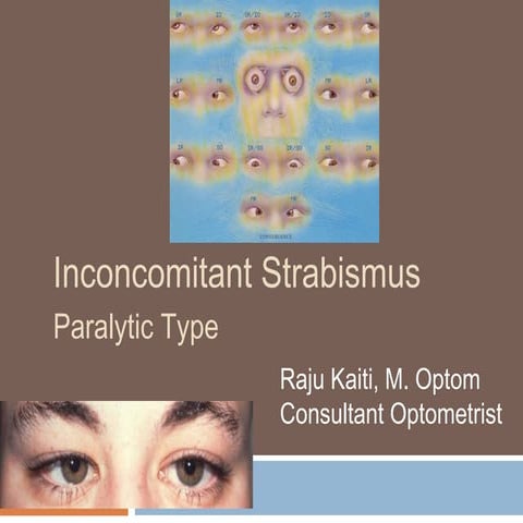 Inconcomitant strabismus types and different tests
