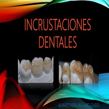 Técnica de restauración de clase i oclusal | PPTX