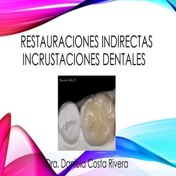 6. Preparaciones Onlay y Overlay preparacion para incrustaciones .pptx
