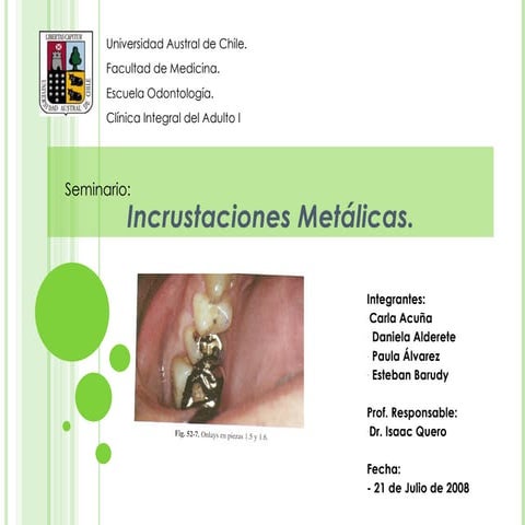 6. Preparaciones Onlay y Overlay preparacion para incrustaciones .pptx