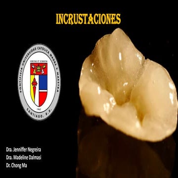 Incrustaciones inlay, onlay y overlay | PPTX