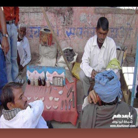 Indicaciones endodonticas parte 2