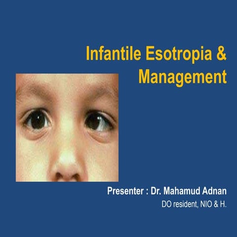 Infantile esotropia by dr adnan