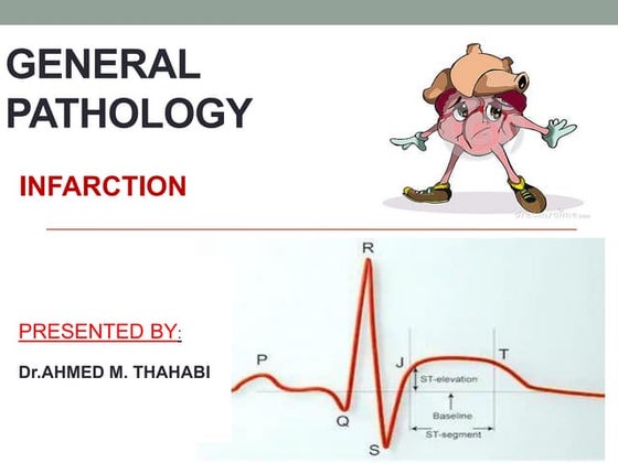 edema pathology | PPT