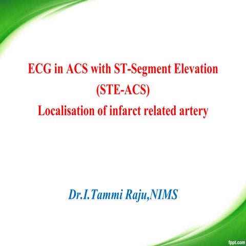 Infarct localisation