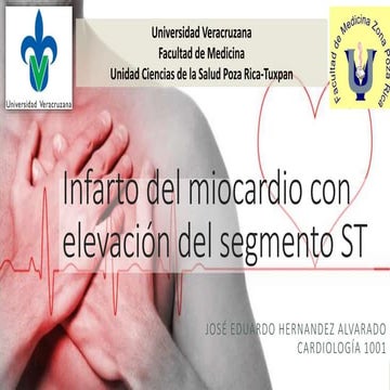 CARDIOLOGÍA, INFARTO AGUDO DE MIOCARDIO CON ELEVACION DEL SEGMENTO ST.pptx