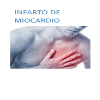 Infarto de miocardio