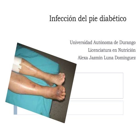 Pie diabetico infectado parte 2 | PPTX