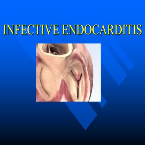 ENDOCARDITIS | PPTX