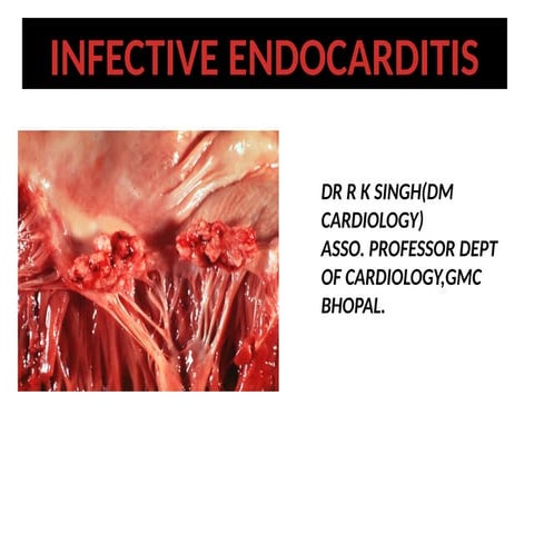 INFECTIVE ENDOCARDITIS PPT for Medical Graduates | PPTX