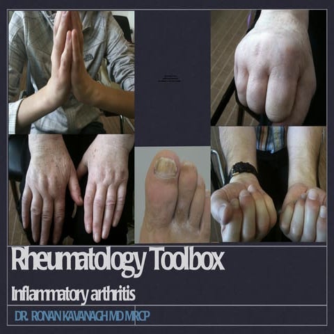 Inflammatory arthritis; a quick run through.
