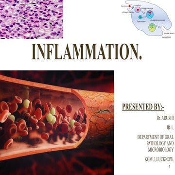 INFLAMMATION - GENERAL CHARACTERTISTICS | PPTX