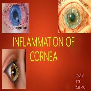 Inflammation of cornea