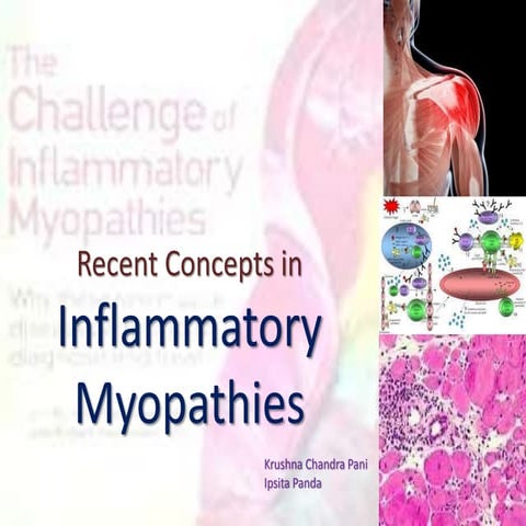 Inflammatory Myopathies