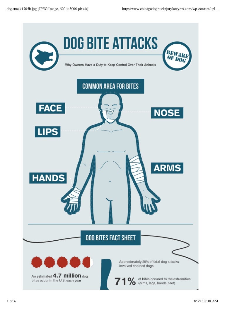 Dog Bite Lawyers Present Infographic For Victims Of Dog Attacks
