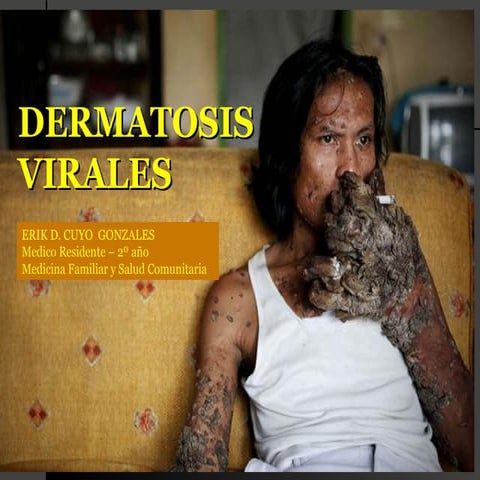 infecciones viricas en piel