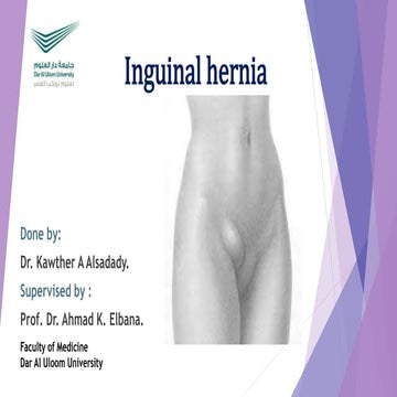 Inguinal hernia