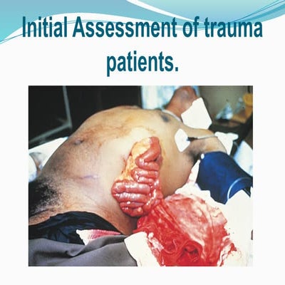 Initial trauma assessment presentation.pptx