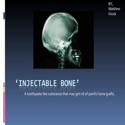 Injectable Bone’1