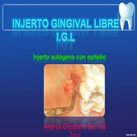 Injerto gingival libre