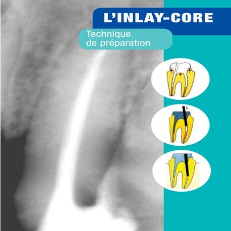 FACEBOW TRANSFER IN COMPLETE AND PARTIAL DENTURE PROSTHODONTICS | PPTX