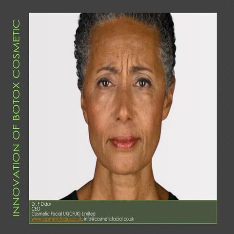 Innovation of botox cosmetic