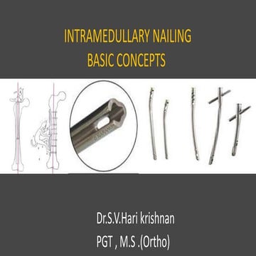 Inra medullary nailing - basic concepts