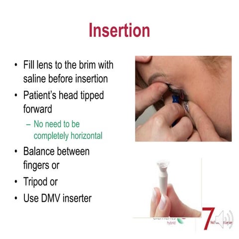 Insertion and removal of rgp contact lens. | PPTX