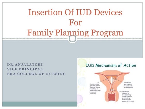 Intrauterine device (IUD) | PPT