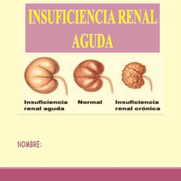 Insf. Renal aguda | PPTX