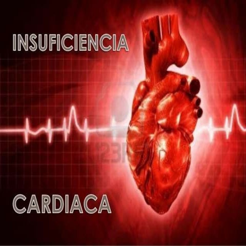 insuficiencia cardiaca.pptx