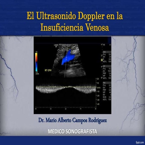 La Ecografía Doppler en la Insuficiencia Venosa