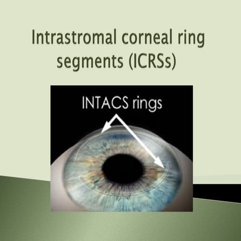 Intrastromal Corneal Ring Segment (ICRSs)