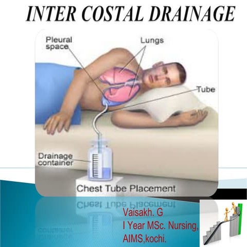 Inter costal drainage  vaisakh