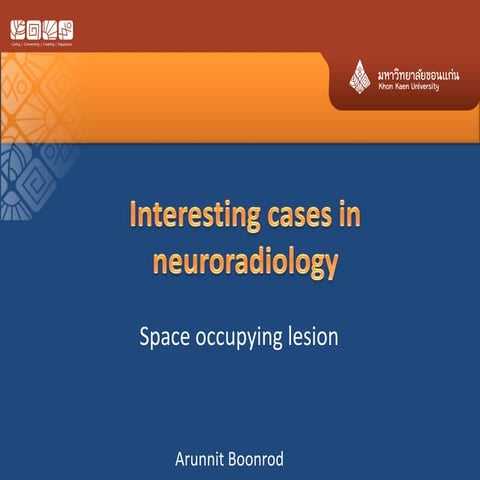 Basic approach to brain tumor | PPTX