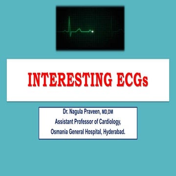 INTERESTING ECGS -- PART II