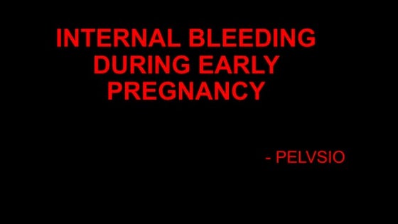 Ibuprofen In Pregnancy Causing Internal Bleeding photo