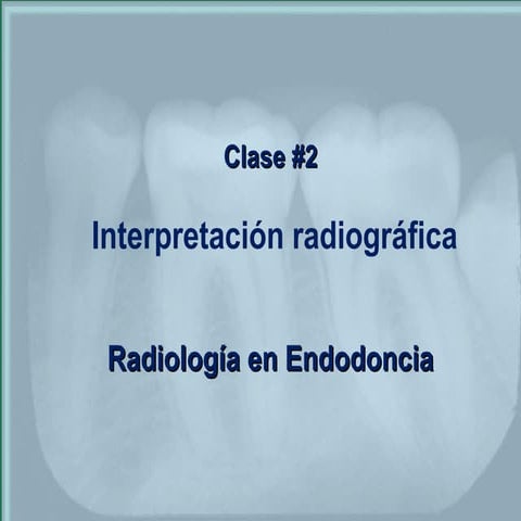 Interpretación de radiografías