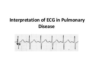 Interpretation of ecg_in_pulmonary_disease