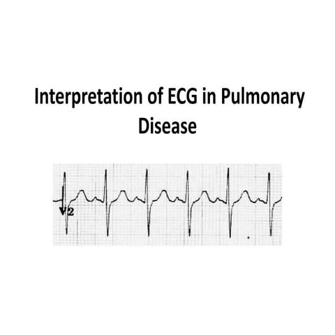 Interpretation of ecg_in_pulmonary_disease