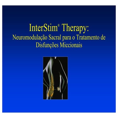 Interstim dr marcio averbeck | PDF