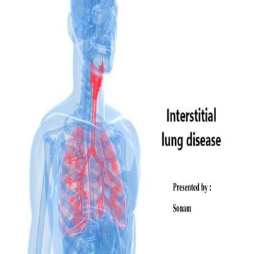 Interstitial lung disease (ILD) ppt slideshare
