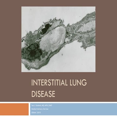 Interstitial lung disease | PDF